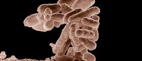  Low-temperature electron micrograph of a cluster of E. coli bacteria, magnified 10,000 times. Each individual bacterium is oblong shaped. Image: public domain via Wikimedia Commons